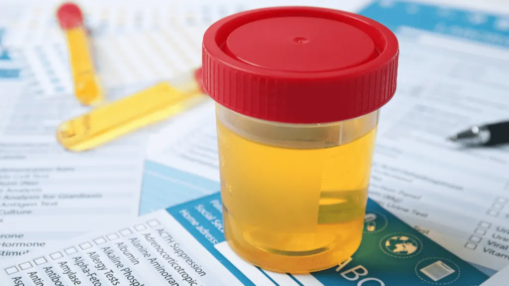 Muestra de orina para test de alcohol y drogas